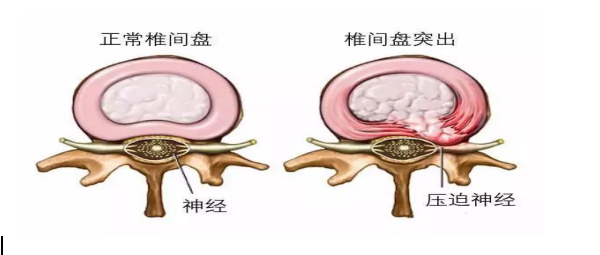 关注健康  、从保护脊柱开始
