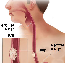 科学防治  、与“食”俱进