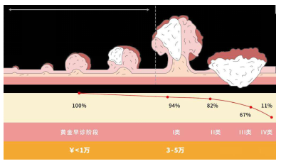 科学防治消化道早癌