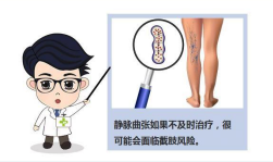预防下肢静脉疾 呵护人生健康路