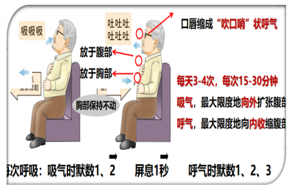  个性化自我健康管理  肺康复训练