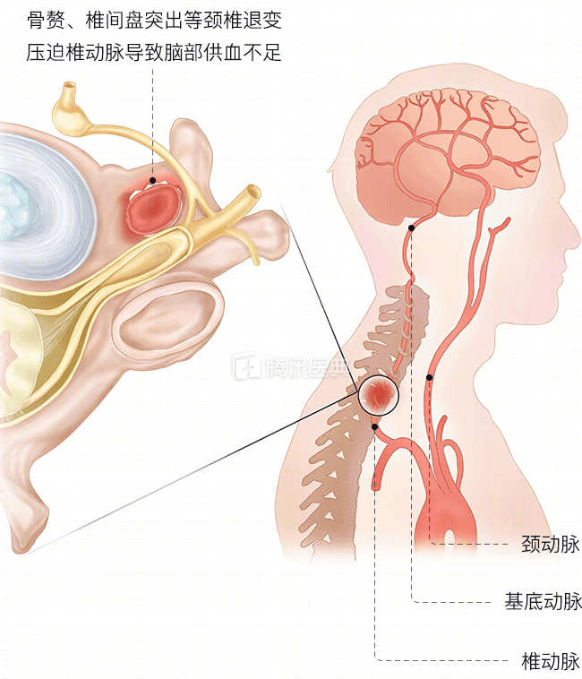 腿麻总不好，原来是它惹的祸！