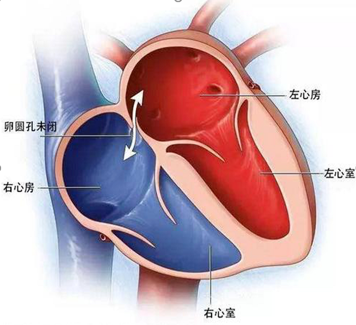 偏头痛的痛谁懂？发泡实验“@了你”