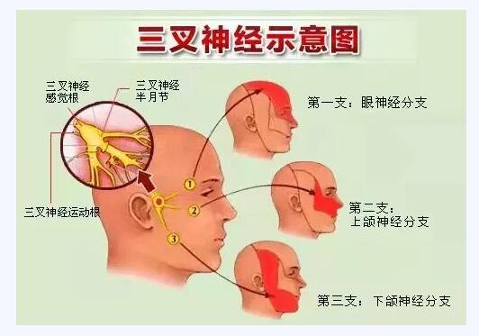 它才是医学界公认的天下第一痛