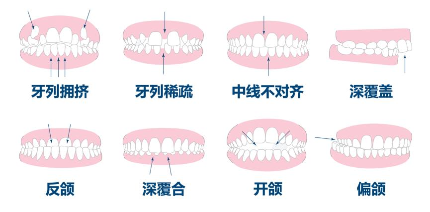 开挂人生，竟始于这个不起眼的改变